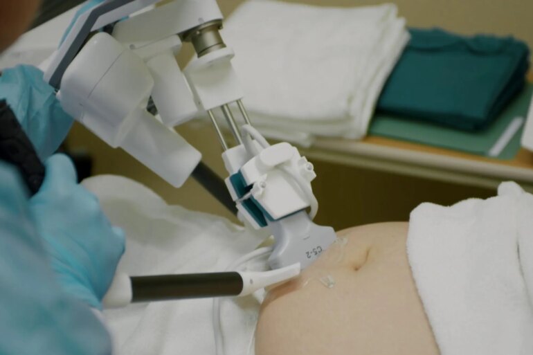 SCIENCE & TECH: Alabama’s plan to put robots in maternity