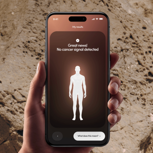 A hand holding a smartphone showing a "no cancer signal detected" result from a blood test.